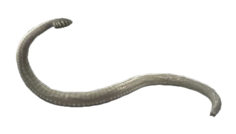 Човешки паразити