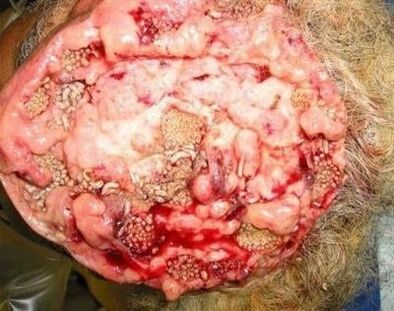 паразити в човешкия мозък